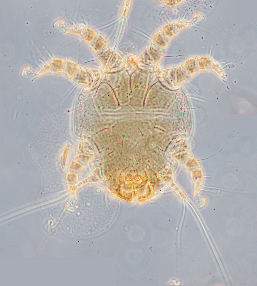 Chaetodactylus birulai syntype HDN, ventral view