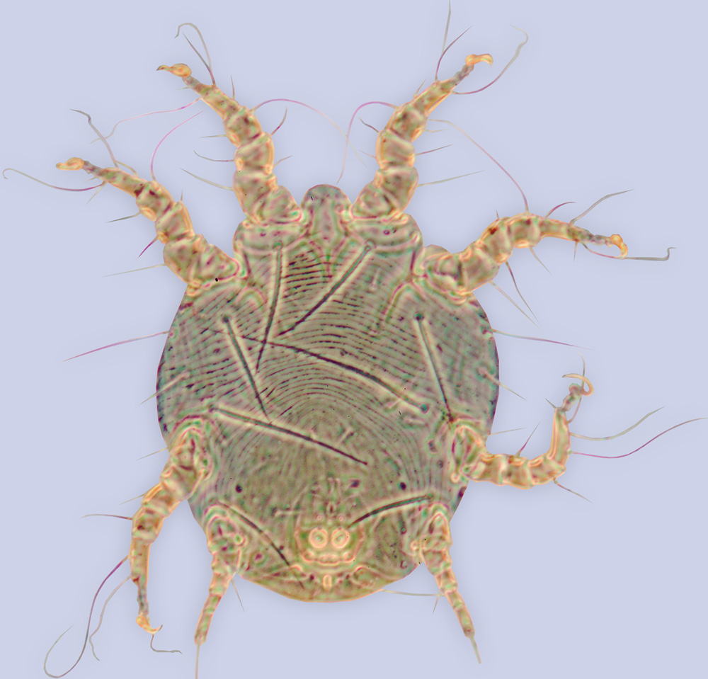 Sennertia delfinadoae, holotype, phoretic deutonymph, ex Platacanthomys lasiurus (Rodentia, Platacanthomyidae) (accidental host), India, BMOC 11-0930-001