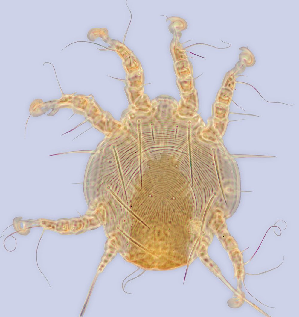 Sennertia potanini, phoretic deutonymph (lectotype), ex Xylocpa tranquebarorum (or X. rufipes), China, BMOC 11-0618-004
