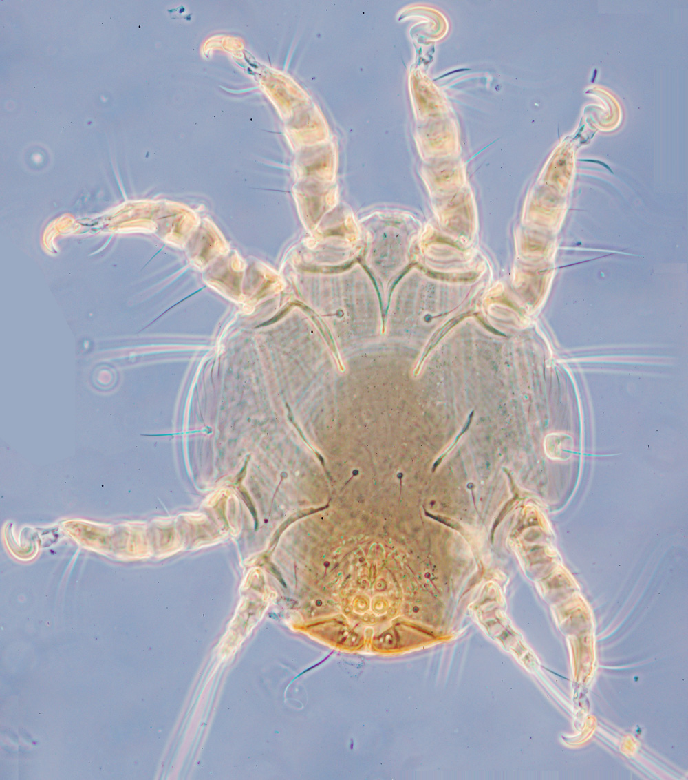 Sennertia potanini, lectotype heteromorphic deutonymph, ventral