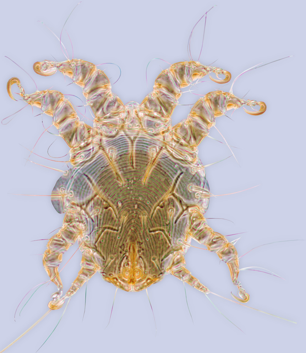 Sennertia ratiocinator, phoretic deutonymph (holotype), ex Xylocopa bhowara, Sri Lanka, BMOC 05-0420-066